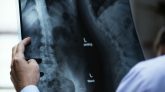 imagen precedir