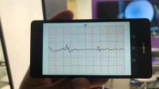 electrocardiógrafo