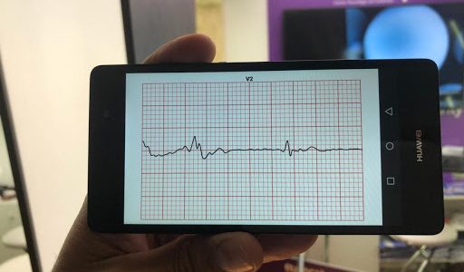 electrocardiógrafo