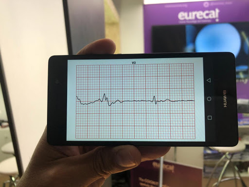 electrocardiógrafo